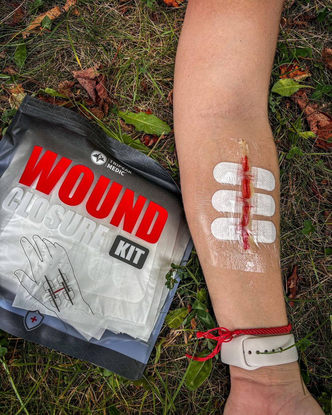 Advanced Wound Closure Kit